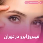 فیبروز ابرو در تهران