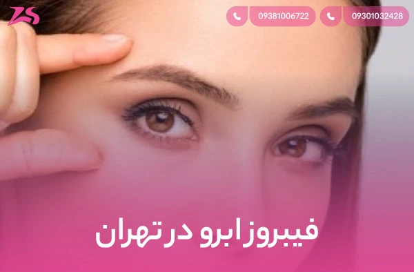 فیبروز ابرو در تهران