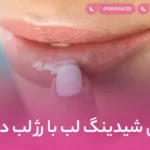 فرق شیدینگ لب با رژ لب دائم