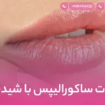 تفاوت ساکورالیپس با شیدینگ