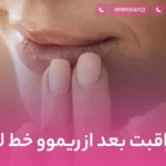 مراقبت بعد از ریموو خط لب