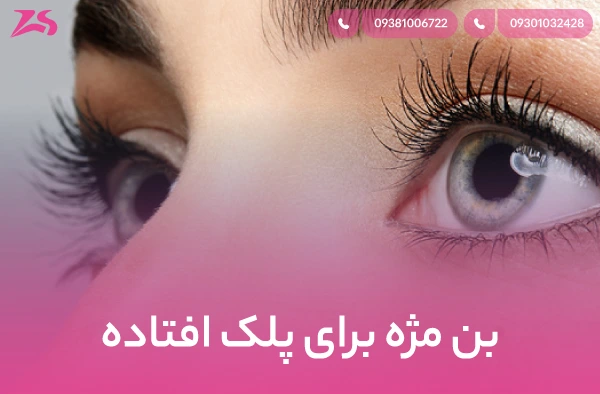 بن مژه برای پلک افتاده