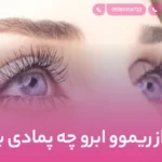 بعد از ریموو ابرو چه پمادی بزنیم