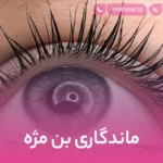 ماندگاری بن مژه