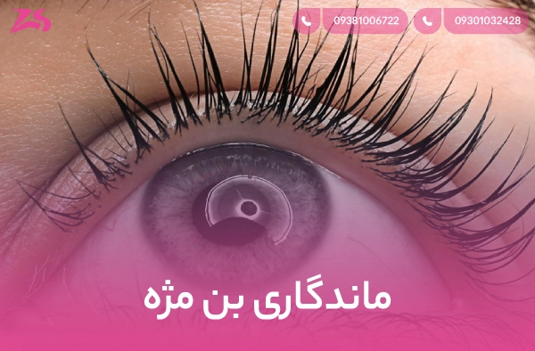 ماندگاری بن مژه