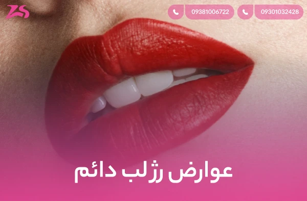 عوارض رژ لب دائم